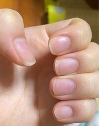 爪の白い部分がとてもいびつな線をかたどっています まだ学生なのでネ Yahoo 知恵袋