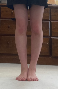 この足は細いですか 普通ですか 太いですか また痩せるならやはりふくらはぎで Yahoo 知恵袋