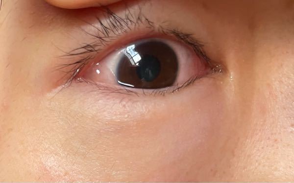 至急猫アレルギー 猫を触っていたら両目がパンパンに腫れ 白目に Yahoo 知恵袋