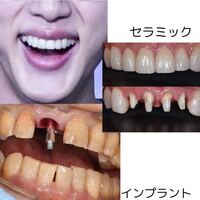 BTS キムソクジン ジン セラミックコースター