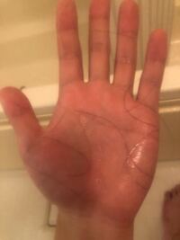 シャンプーした後の手を見たら毎回このくらい抜け毛が出るのですが こ Yahoo 知恵袋