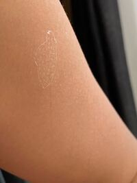 日焼けして皮がめくれて来たんでめくったらこんな白いの 多分皮 これ Yahoo 知恵袋