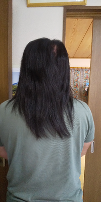 男性ですがヘアドネーションが目的で髪を伸ばしてます。
今この長さですがヘアドネーションはできますか？
まだ長さが足りませんか？ 