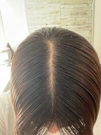 私禿げてませんか これはオイルつけすぎてベタベタなだけです 禿げてると思いま Yahoo 知恵袋