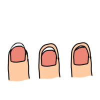 深爪って右の状態の事だと思うんですけど真ん中も深爪ですか 自分が真ん中 Yahoo 知恵袋