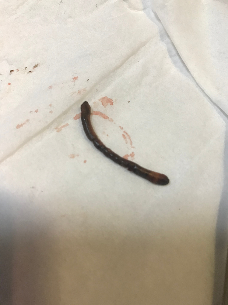 庭の睡蓮鉢でアマガエルのオタマジャクシを飼っています 変態して次々 Yahoo 知恵袋