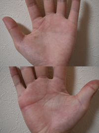 赤ちゃんってみんな両手ますかけ線がありますか もうちょっとで9ヶ月の Yahoo 知恵袋