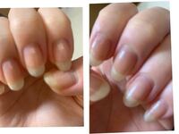 爪の先端のへこみに関して 最近 セルフでジェルネイルをはじめたのですが写真 Yahoo 知恵袋