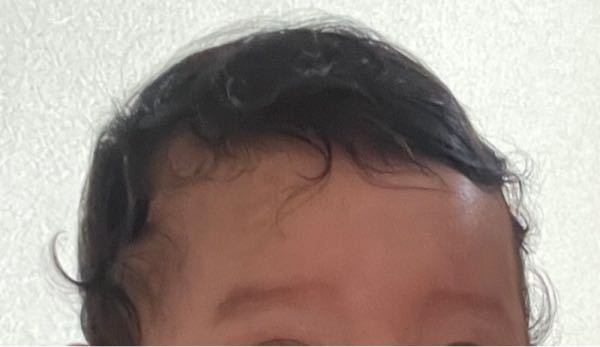 赤ちゃんの産毛について こちらでもたくさん質問されてるのですが 私の Yahoo 知恵袋