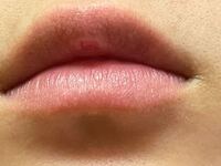 一昨日から唇が小さいブツブツみたいなのが出来てて 免疫が下がっ Yahoo 知恵袋