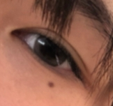目の縦幅を広げる 縦幅があるように見える 整形は涙袋 二重系以外になにがあり Yahoo 知恵袋