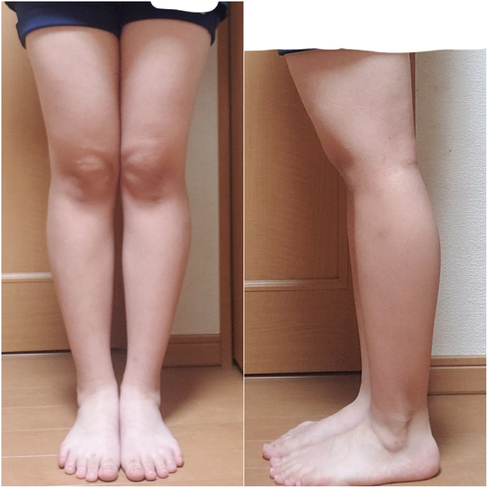 高3女子です。 - 今まで足が太いことがコンプレックスで足を隠すワイド