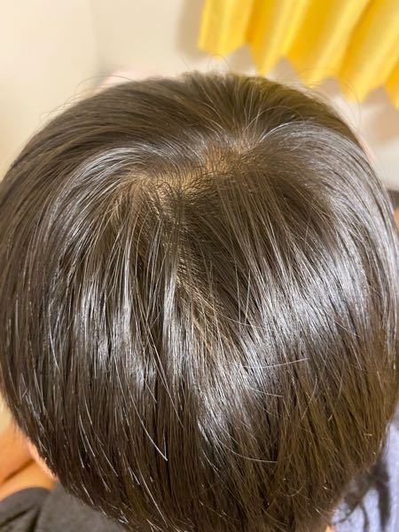 高1男子です元々髪の毛自体が細く柔らかい毛で毛量もなかったんですが最近つむじ Yahoo 知恵袋