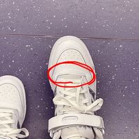 Adidasの靴を買ったのですが 画像赤丸部分がとても痛いです 履 Yahoo 知恵袋