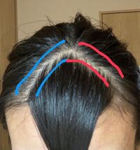 赤と青の前髪どちらの生え際がいいと思いますか 青 Yahoo 知恵袋