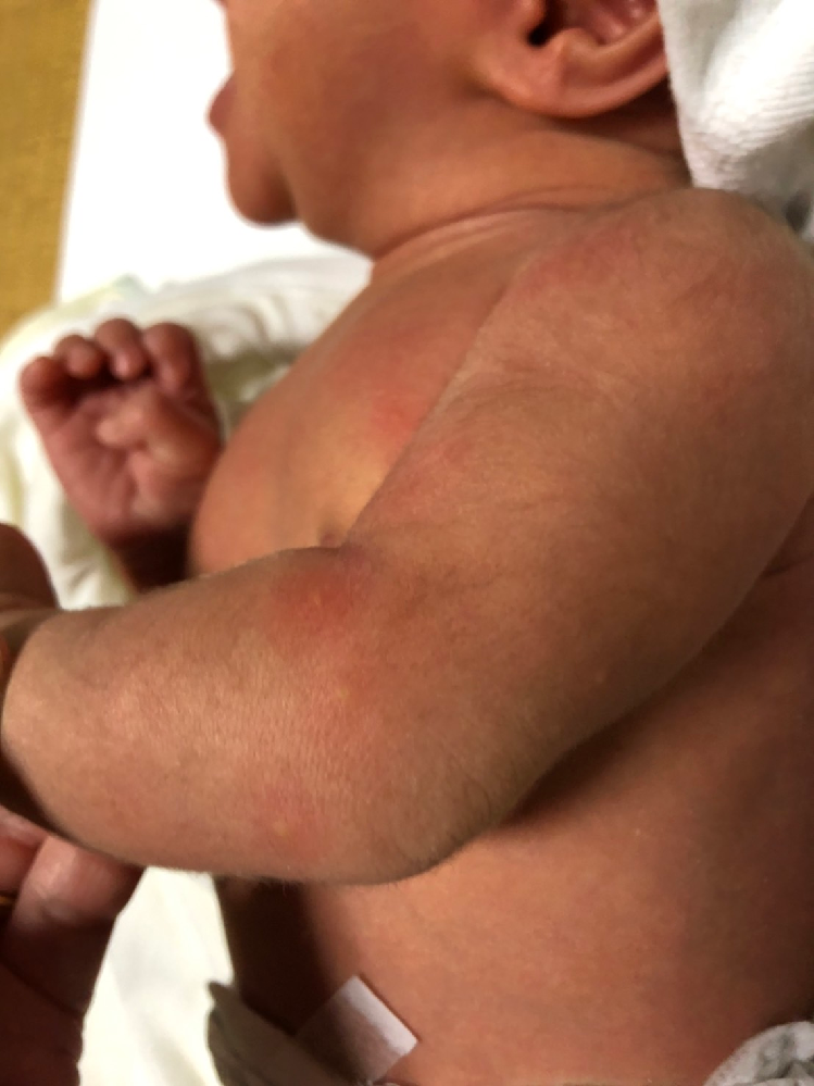 4ヶ月の赤ちゃんが両手を勢いよく大の字に何度も広げるのですが普通のことで Yahoo 知恵袋