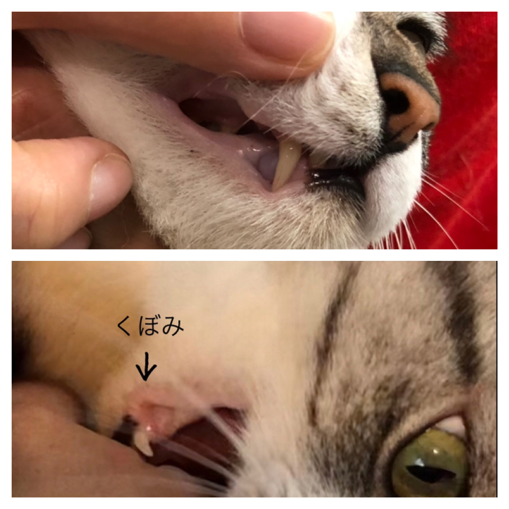 猫の犬歯が唇の柔らかい場所にに刺さっています。 常に猫の下顎の唇に窪みが出来、ビロンと伸びた状態になっています。 痛がったりご飯を食べるのに支障を来たしたりの素振りは見られませんが、放置しておくと何か病気に発展しないか心配です。 8月末まではこのような状態ではありませんでした。 これは猫にはよくある事ですか？ すぐ獣医に診せるべきでしょうか、アドバイスいただけたら嬉しいです。