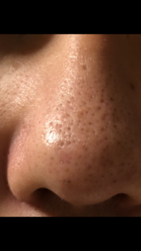 メイクをした時 鼻の毛穴が白くなってしまいます 特にファ Yahoo 知恵袋