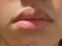 男ですこれはたらこ唇でしょうか 自分ではたらこ唇だと思うし ブサイ Yahoo 知恵袋