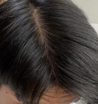 高校生です 分け目が透けてしまいます 薄いでしょうか どうすればいいですか Yahoo 知恵袋