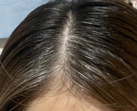 32歳女です 代からメッシュのように白髪が前髪だけあり どんどん広 Yahoo Beauty