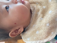 赤ちゃんの頭を掻く癖について 3ヶ月の赤ちゃんなのですが 寝起きやおっぱ Yahoo 知恵袋