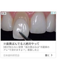 Lineのゲームのツムツムで課金したのにルビーが反映されないんで Yahoo 知恵袋