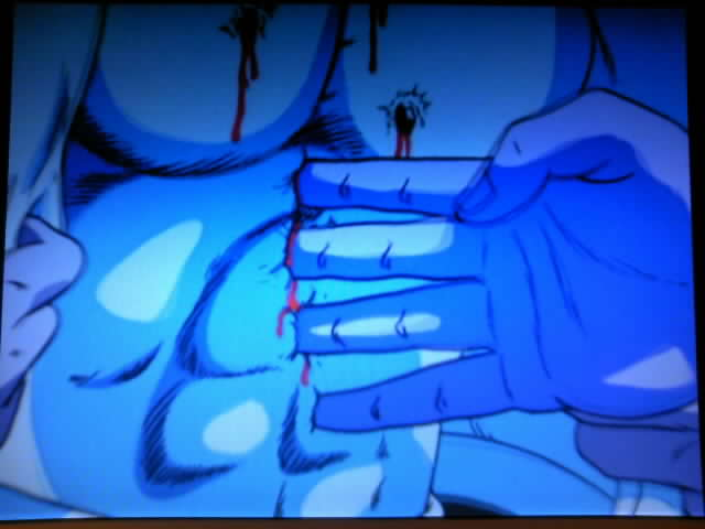 北斗の拳のアニメでケンシロウは、シンから指で７つの傷をつけられた 