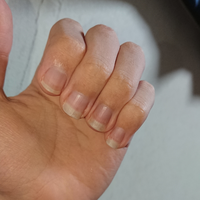 今深爪だった爪を伸ばしてるんですがどのくらいで普通の人の爪になりますかね Yahoo 知恵袋