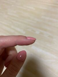 ジェルネイルで指先が黒くなってきます ジェルネイルを施してもら Yahoo 知恵袋