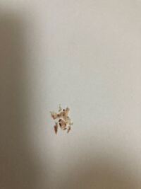 頭皮を掻いて瘡蓋を剥がす癖が治りません オンライン授業になっ Yahoo 知恵袋