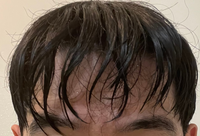 大至急 くせ毛なんですけど 濡れた時写真のようにスカスカになってし Yahoo 知恵袋