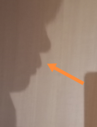 横顔が終わってます 出っ歯ではないのですが矢印の部分が肉 と Yahoo 知恵袋