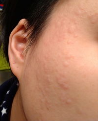 スープ 遠え 尊敬する アレルギー 化粧品 祈り 留め金 湿地