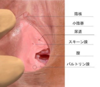 詳しい方回答よろしくお願いします これ拾ってきたバルトリン腺の画像なん Yahoo 知恵袋