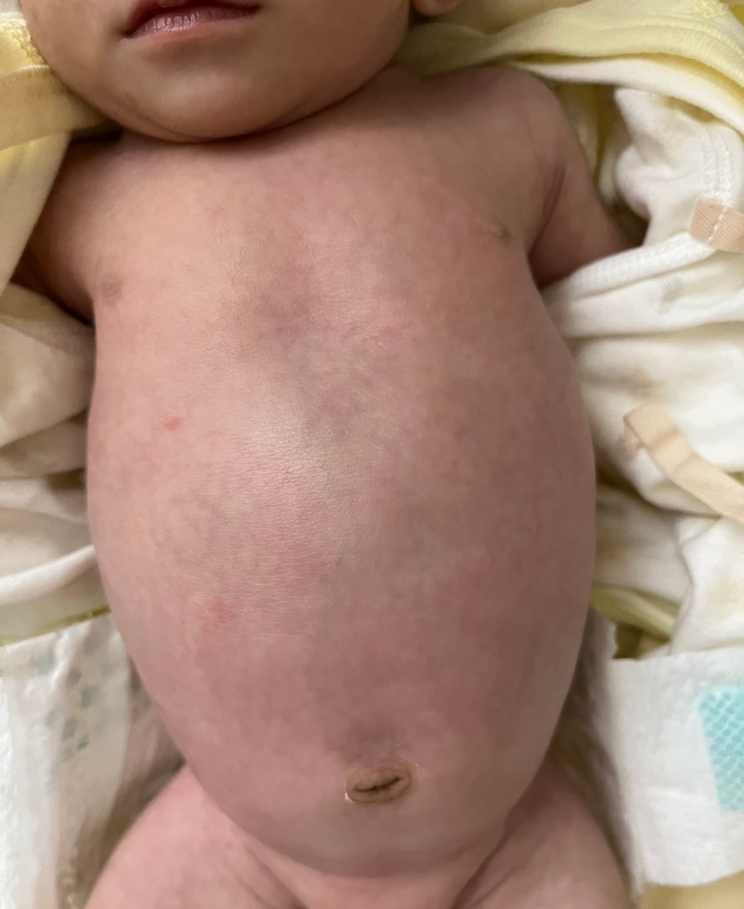 子どもの病気とトラブル 解決済みの質問 Yahoo 知恵袋