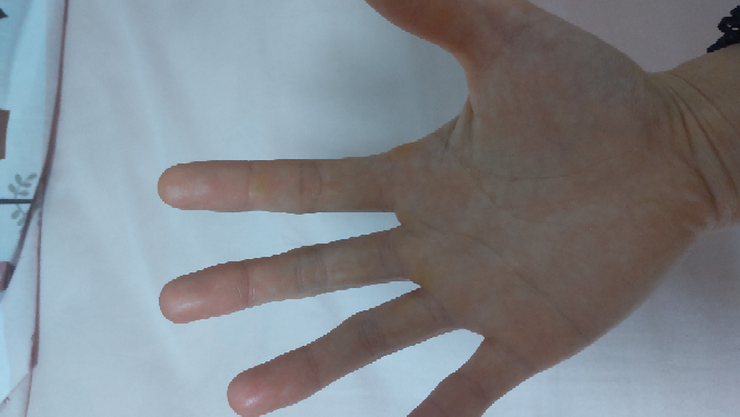 夢占い夢占いに詳しい人お願いします 妻の両腕がカーテンにくっついた Yahoo 知恵袋