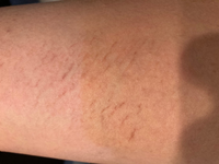 肉割れについて 画像有 閲覧ありがとうございます 身長155体重50キロの高 Yahoo 知恵袋