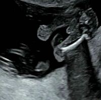 こんにちは 現在妊娠5ヶ月なのですが17週のエコーでシンボルがあるので男の子 Yahoo 知恵袋