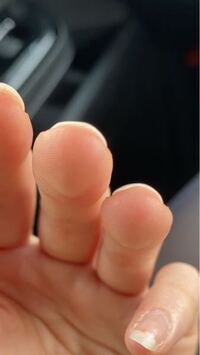 ハイポキニウムの伸ばし方を教えてください オイルとか塗ってもマッサージ Yahoo 知恵袋