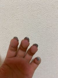 スカルプネイルピンチの際にすごく痛かったです 中指だけ 何か Yahoo 知恵袋