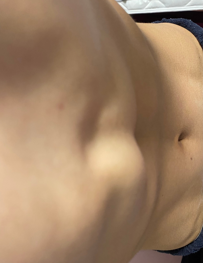 質問です写真を見ていただけるとわかるのですが胸の中心にある骨の右側 Yahoo 知恵袋