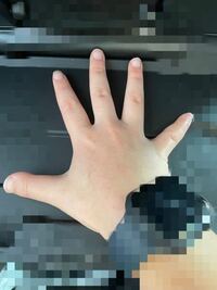 中3女子の手なんですけど生まれつきまむし指で全体的に短いです 小さい時 Yahoo 知恵袋