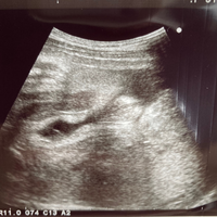 赤ちゃんの性別 エコー画像あり 現在31wの初産妊婦です まだ性 Yahoo 知恵袋