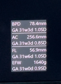 妊娠30週で 胎児の大きさについての質問をさせてください 画 Yahoo 知恵袋