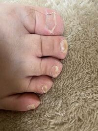 この足でフットネイルできますか 笑われますか Yahoo 知恵袋