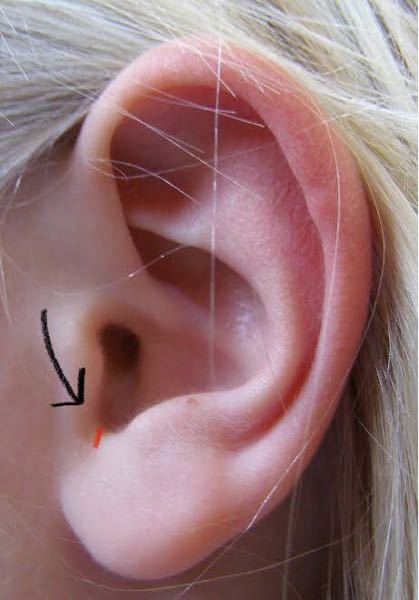 耳の病気 すべての質問 Yahoo 知恵袋