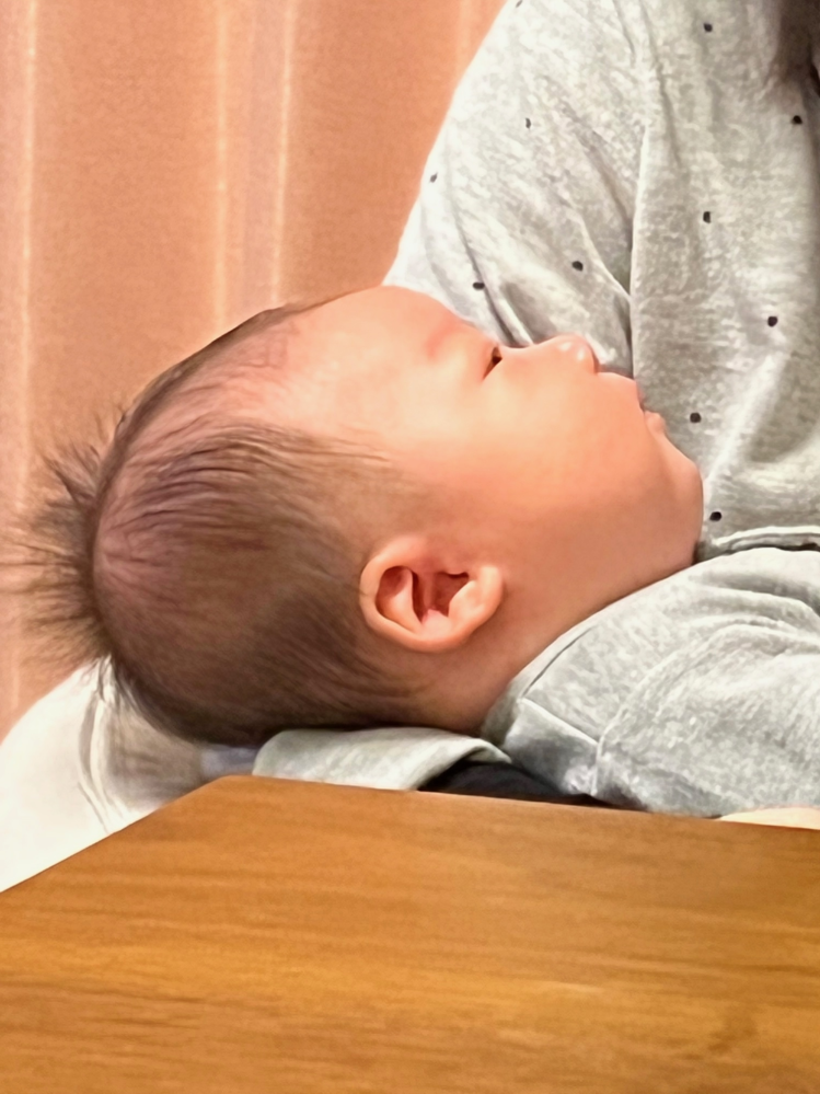 画像あり 生後一か月の息子の頭の形について質問です 息子の頭の形 Yahoo 知恵袋