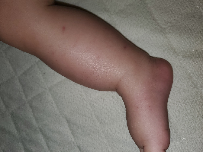 子どもの病気とトラブル 解決済みの質問 Yahoo 知恵袋