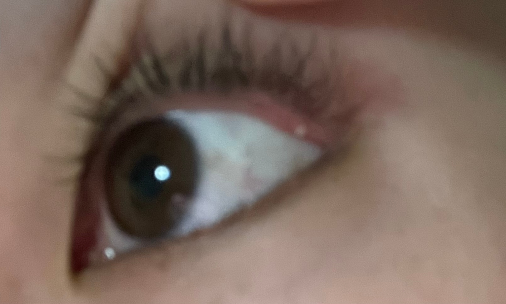 最近目が痛いなぁと思っていて、先ほど鏡で瞼の裏を見てみると白い粒がありました。何かわかる方いら...